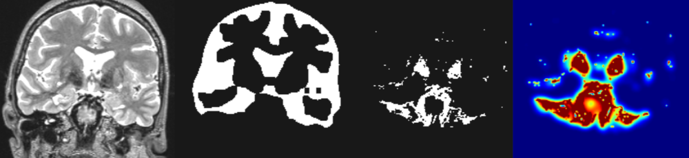 CT-Schnittbild durch menschlischen Kopf in verschiedenen Färbungen